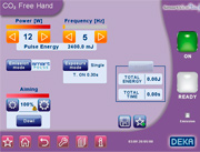 炭酸ガスレーザー SmartXide Touch（スマートサイド・タッチ）可変自在なパラメータ設定